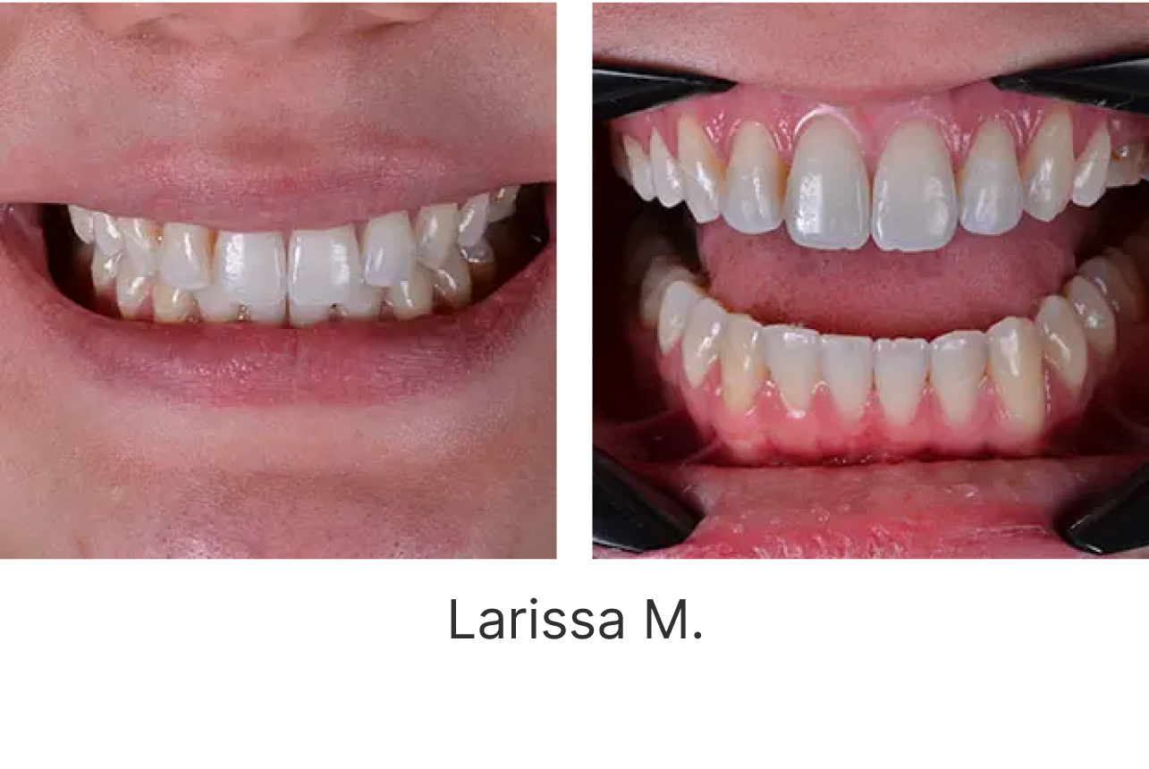 LP Aparelhos Invisíveis Medicina Dentária no Porto