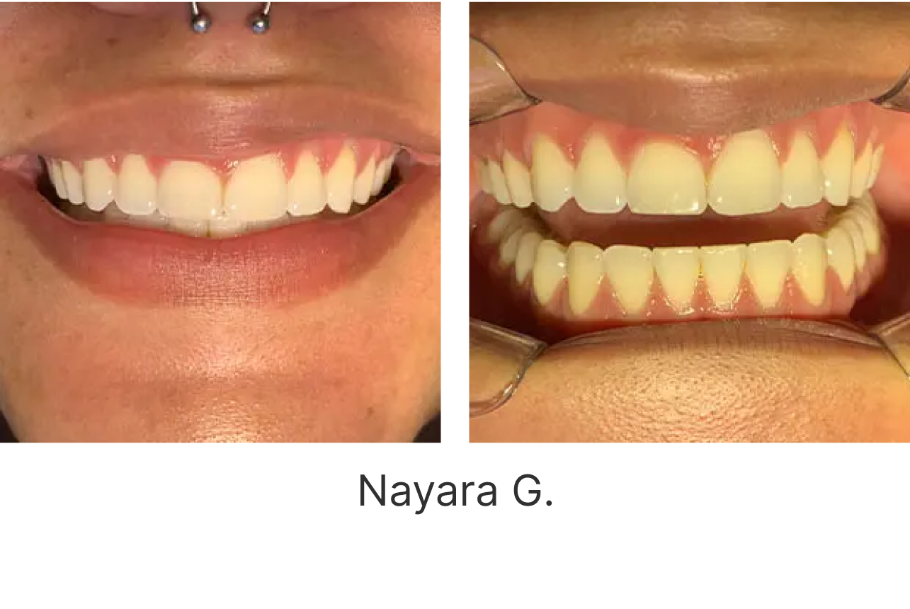 LP Aparelhos Invisíveis Medicina Dentária no Porto
