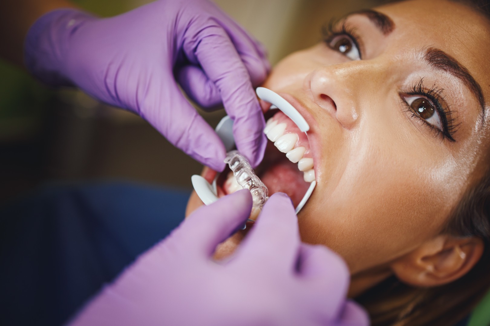Clínica Dentária Aparelho Invisível no Porto