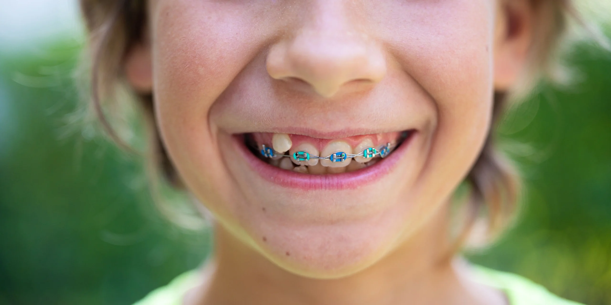 Smile More Clinica Dentaria Em Lisboa E Porto (1)