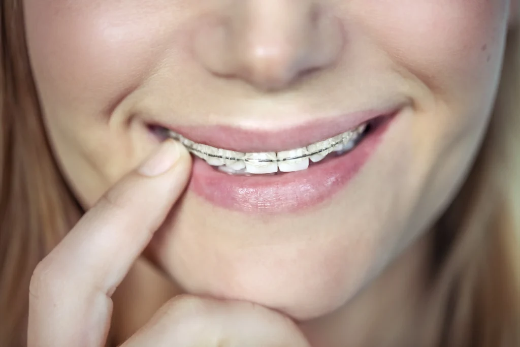 Smile More Clinica Dentaria Em Lisboa E Porto (1)