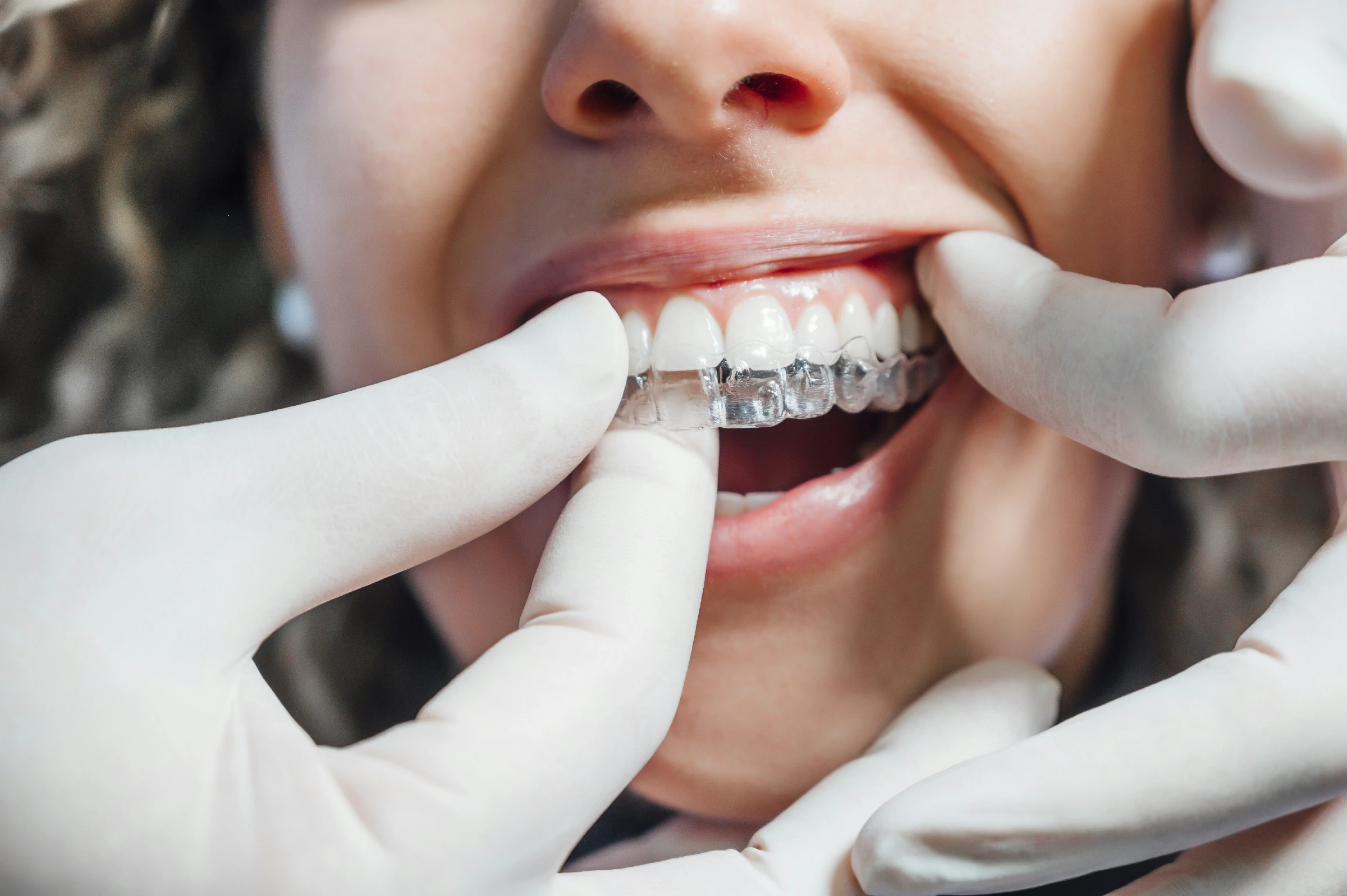 Smile More Clinica Dentaria Em Lisboa E Porto (1)