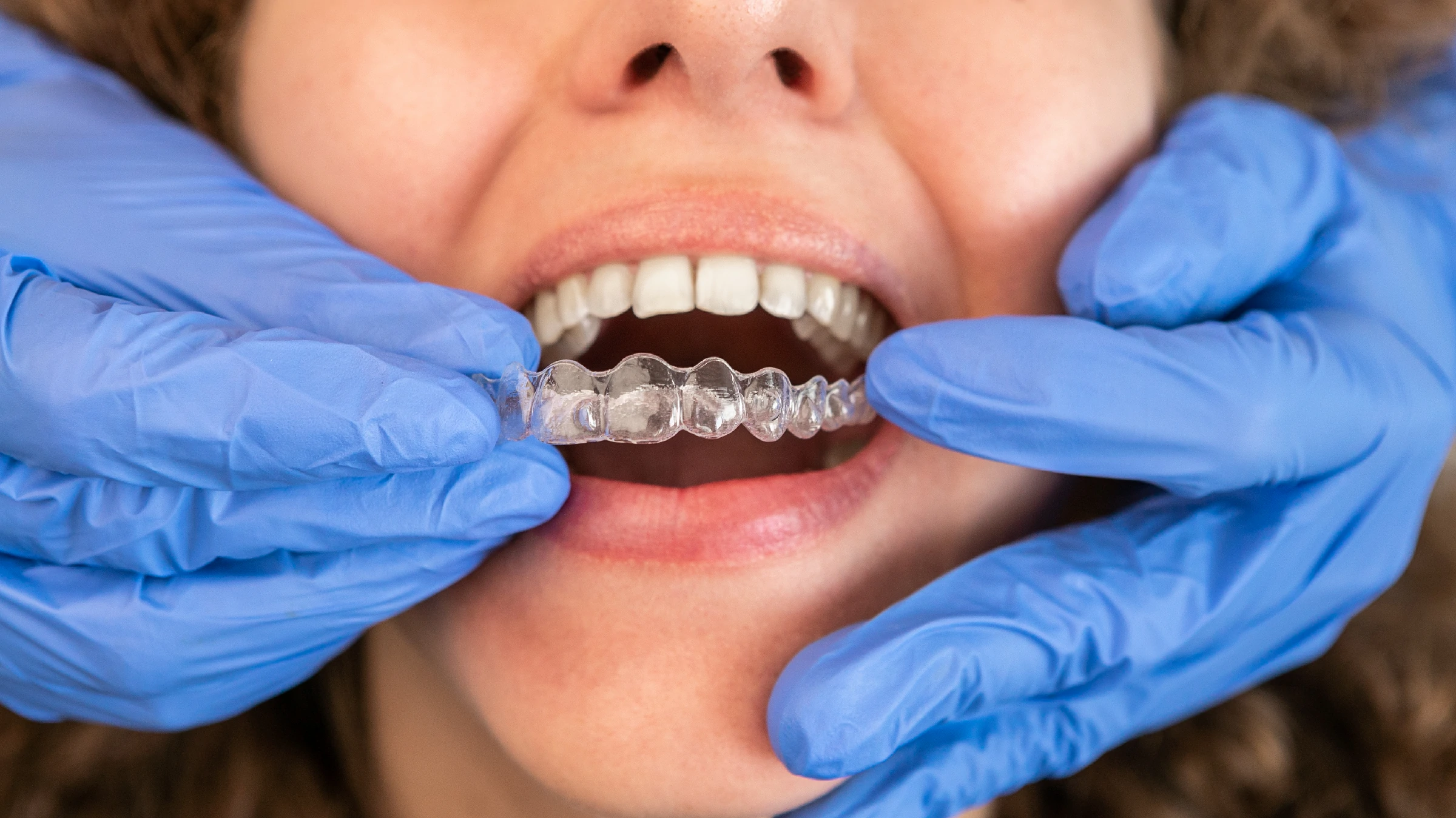 Smile More Clinica Dentaria Em Lisboa E Porto (16)