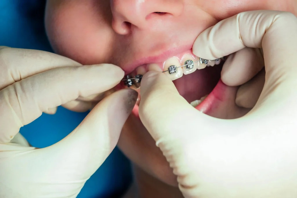 Smile More Clinica Dentaria Em Lisboa E Porto (2)