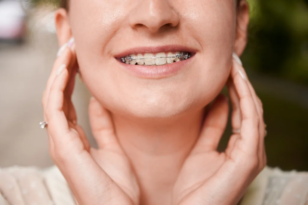 Smile More Clinica Dentaria Em Lisboa E Porto (2)