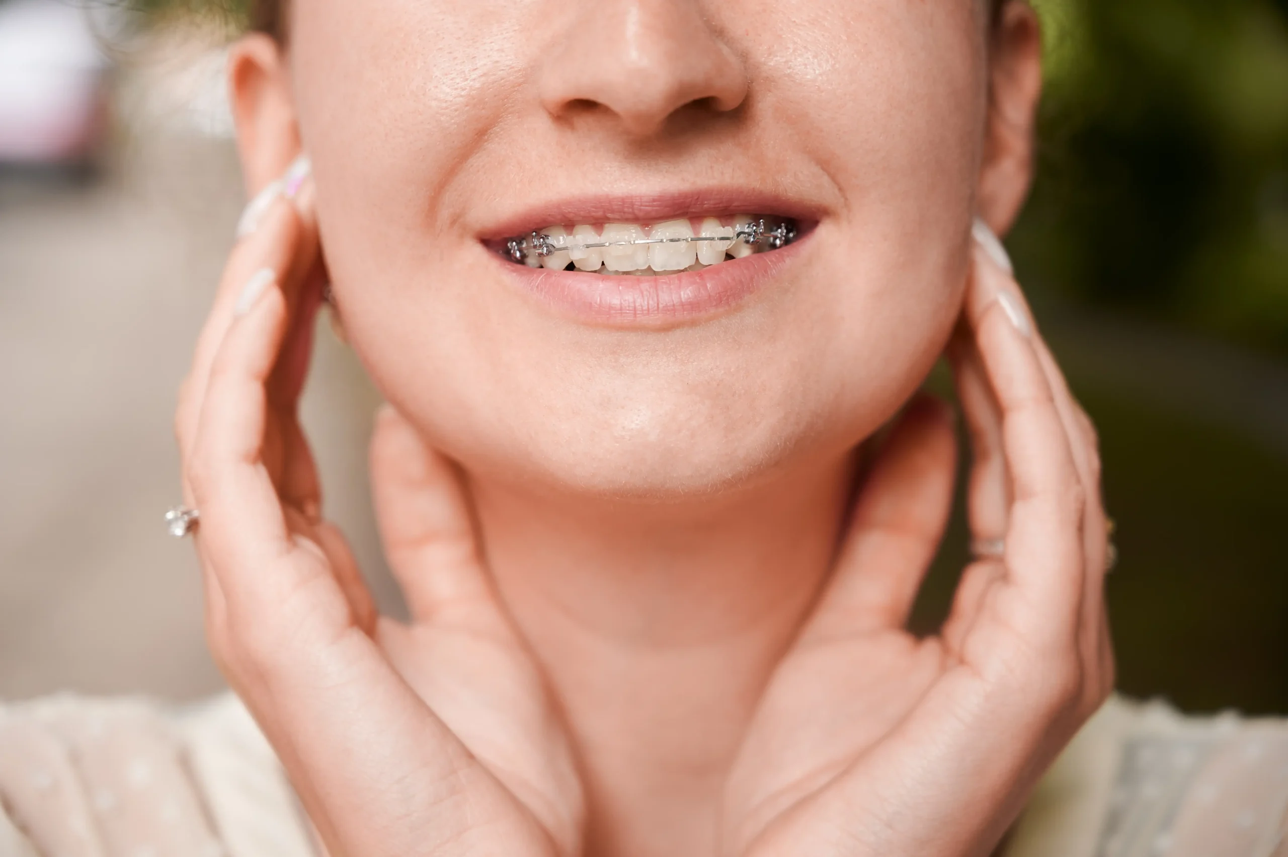Smile More Clinica Dentaria Em Lisboa E Porto (2)