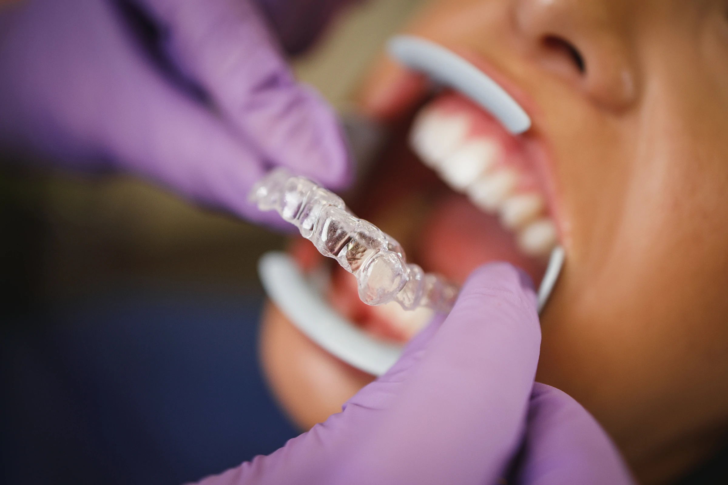 Smile More Clinica Dentaria Em Lisboa E Porto (5)