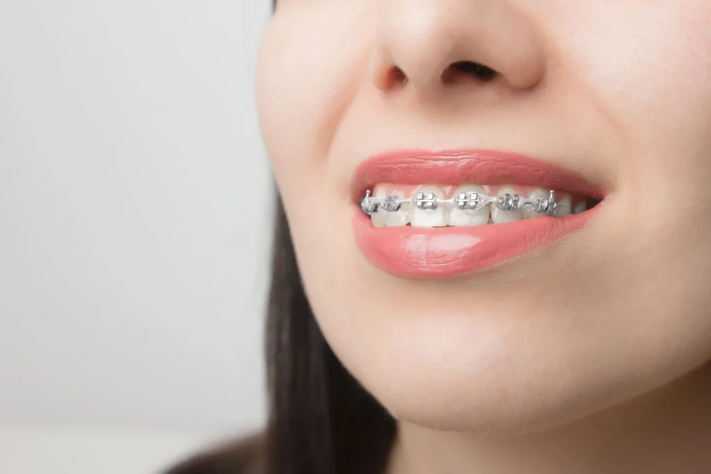 Smile More Clinica Dentaria Em Lisboa E Porto (5)