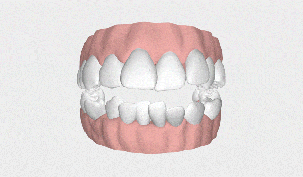LP Aparelhos Invisíveis Medicina Dentária no Porto