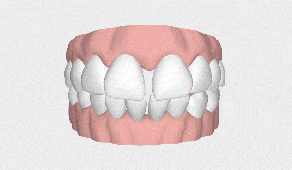 LP Aparelhos Invisíveis Medicina Dentária no Porto