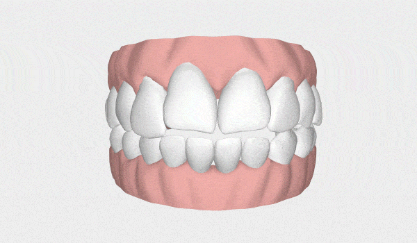 LP Aparelhos Invisíveis Medicina Dentária no Porto