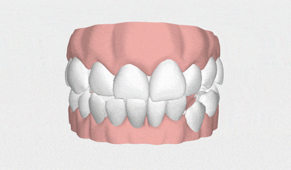 LP Aparelhos Invisíveis Medicina Dentária no Porto