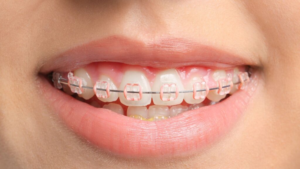 A Smile More Clinic oferece tratamentos eficazes, rápidos e com preços transparentes. Agende!