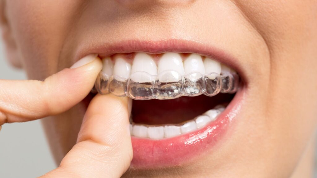 Clínica Dentária Recomendada: Spark e Aparelho Invisível no Porto