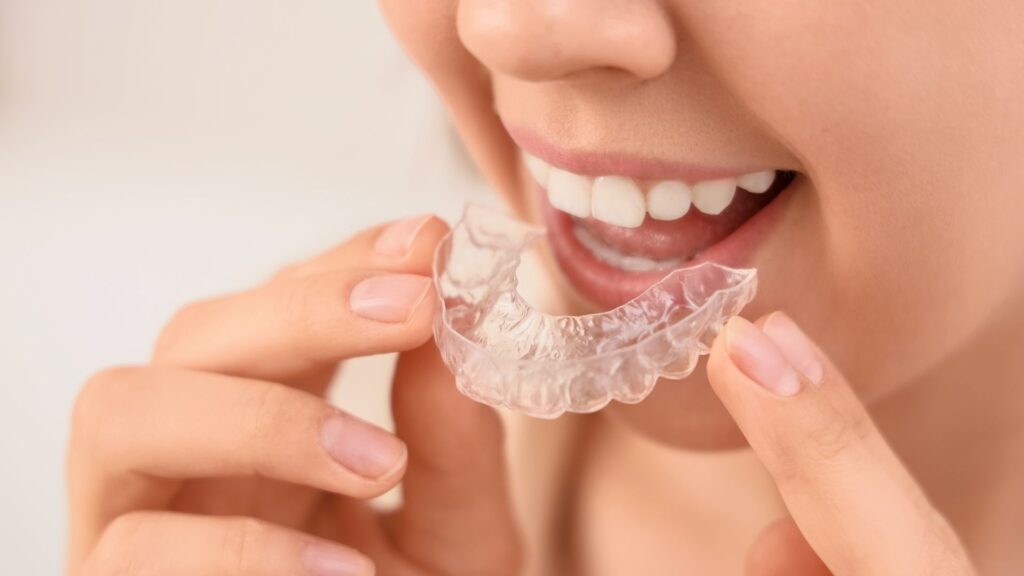 Como e Por Que os Alinhadores Funcionam: A Ciência por Trás do Sorriso Invisível