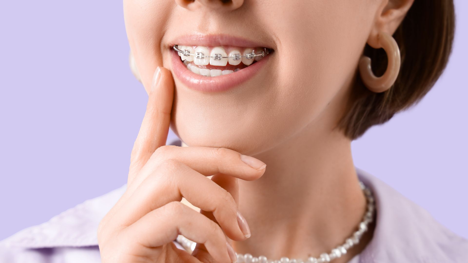 Saiba como funciona o aparelho dentário metálico. Entenda a ciência da pressão, os componentes e as fases do tratamento ortodôntico na Smile More Clinic.
