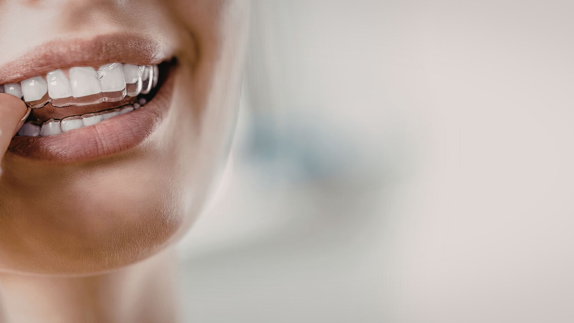 Quando procurar um médico dentista para alinhar os dentes