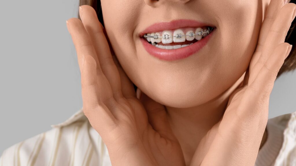 Aparelho invisível ou metálico? Conheça as vantagens, desvantagens e diferenças de custo, conforto e higiene de cada sistema na Smile More Clinic.
