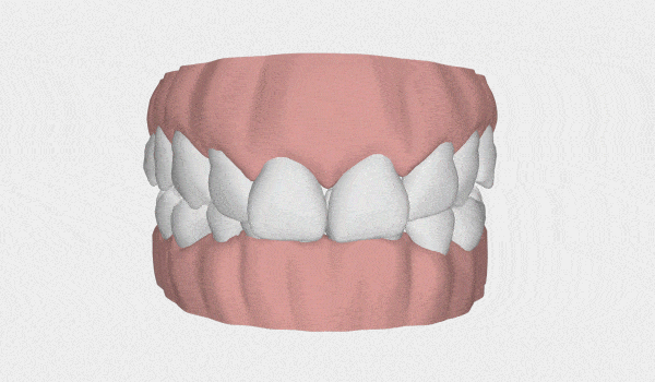 LP Aparelhos Invisíveis Medicina Dentária no Porto